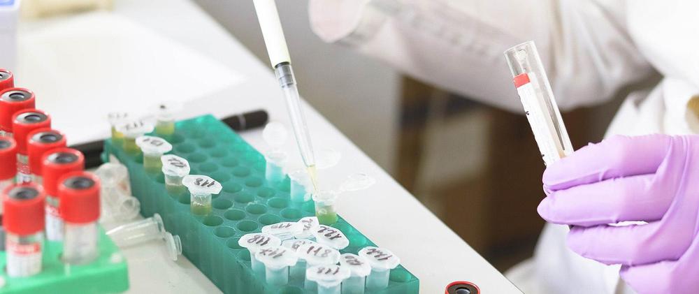 test-coronavirus